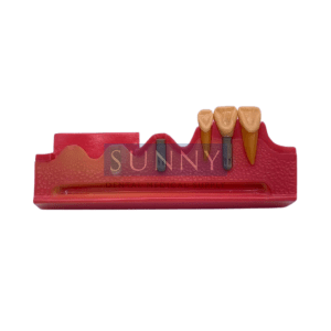 Tooth Study Model – Implant Stages