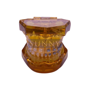 Tooth Study Model – Clear – Ortho
